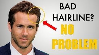 5 Awesome Hairstyles For Widows Peak Receding Hairline