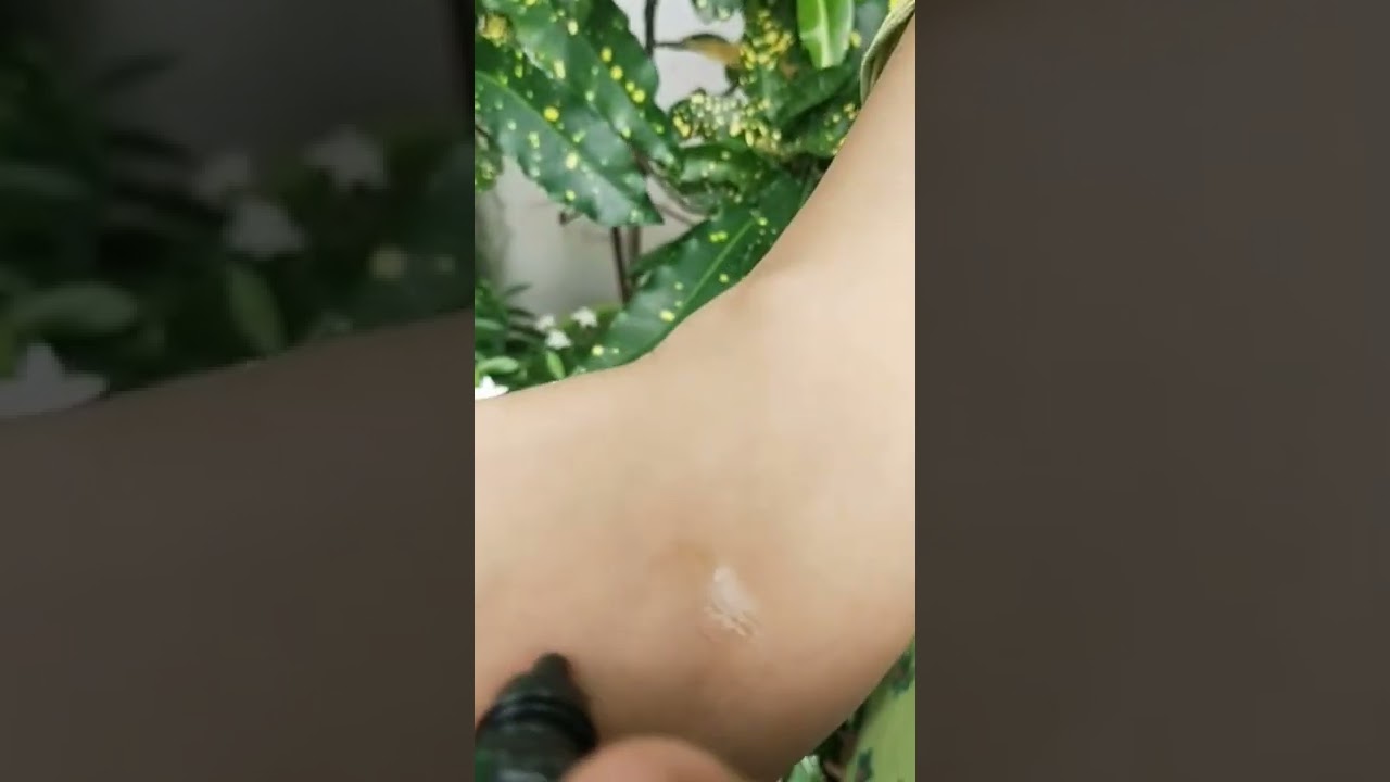 ✨Votre VitmnC,AlphaArbutin Ligtening,whitning&BrighteningSerum