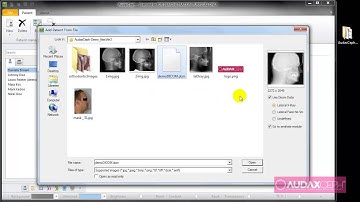 AudaxCeph - Adding Patient When Importing a DICOM File