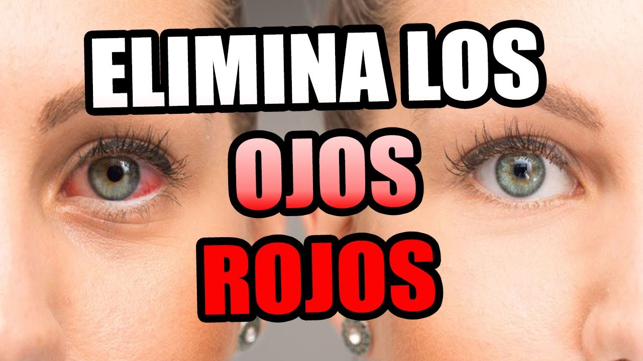 Como quitar los ojos rojos