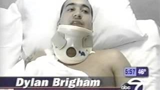 Nerve Transplant Surgery With Living Donor- Dr. Andrew Elkwood