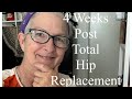Update: 4 Weeks Post Hip Replacement