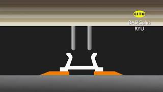 CITO BASICplus RYU