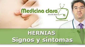 ¿Cómo me doy cuenta que tengo una hernia?