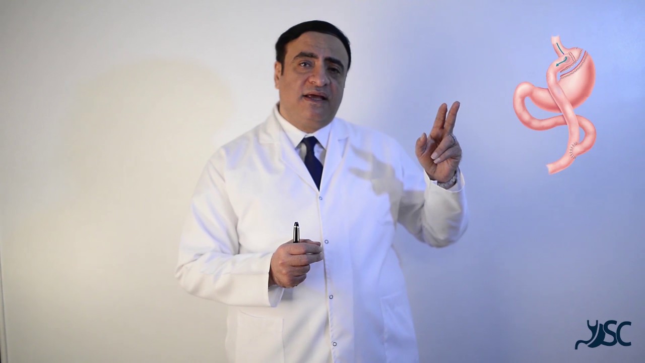 What is Laparoscopic Mini-gastric Bypass?/ما هي عملية تحويل مسار المعدة المصغر/ الكلاسيكي بالمنظار؟