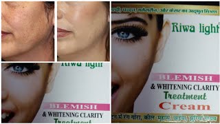 Riwa light cream honest review.💞best for pigmentation,melasma,freckles,pimples🤩.cure skin problems.🤗