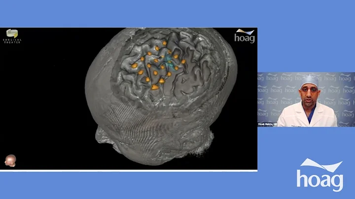 Advancing Surgical Epilepsy Care with VR/AR,  Vive...
