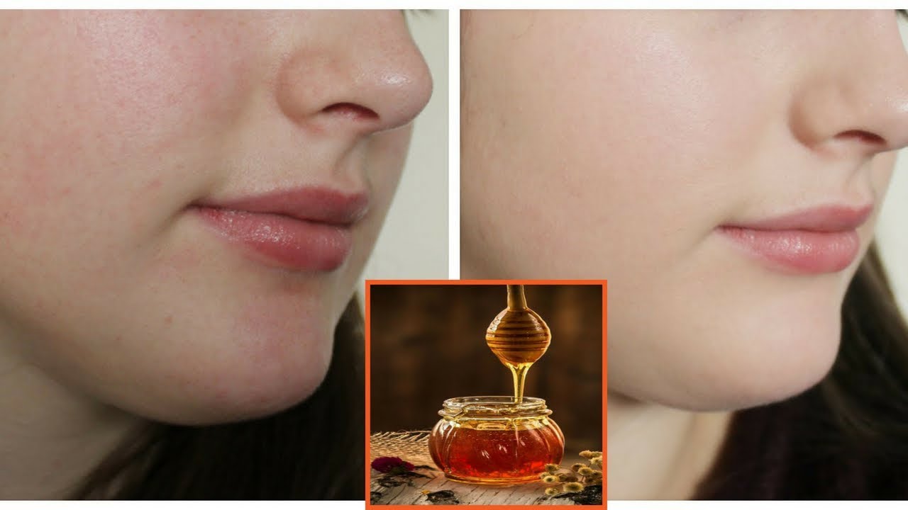 How to Get Clear Skin at home naturally - YouTube