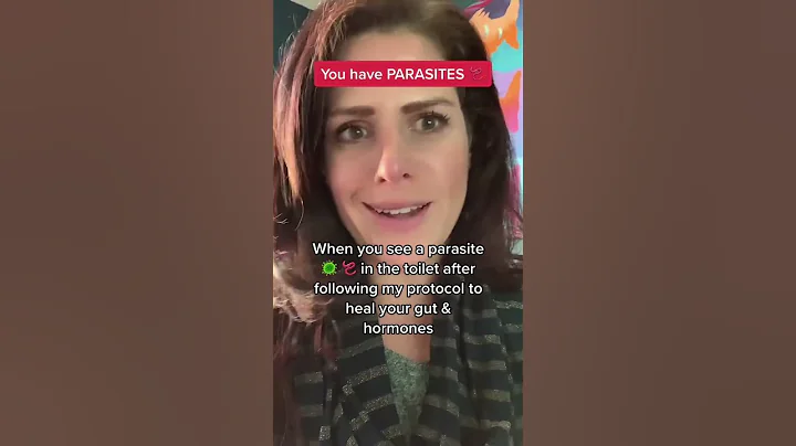 The vast majority of us have parasites. Explain to...