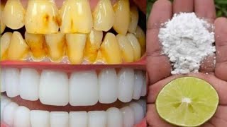 White Teeth at home : पीले गंदे दांतों को मोती की तरह चमकाने का घरेलू नुस्खा