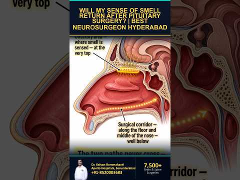 Will My Sense of Smell Return? - Best Endoscopic Pituitary Surgery, Hyderabad | తెలుగు