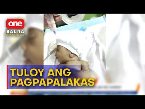 Sanggol na nagka-sepsis, patuloy na nagpapalakas para sa operasyon | One Balita Pilipinas
