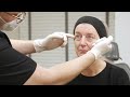 Volumetric facelift - full face lifting technique, using injectable fillers only.