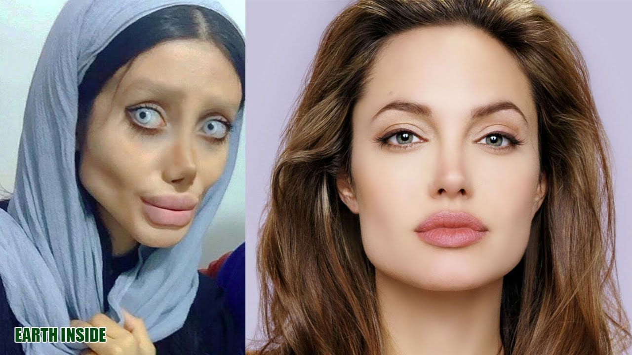 Wanita Ini 50 Kali Operasi Plastik Supaya Mirip Angelina Jolie