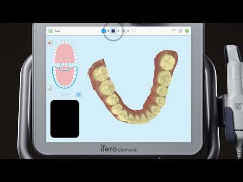 iTero® Scanner Tutorial: Adding a New Case Type