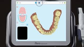 iTero® Scanner Tutorial: Adding a New Case Type screenshot 2