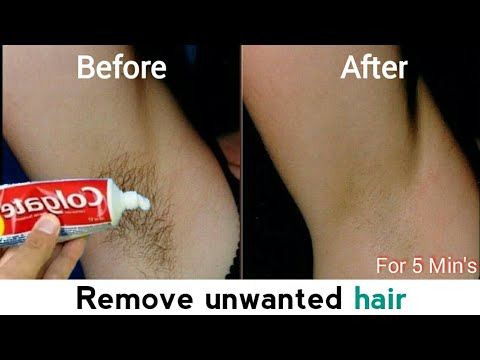 Download Dawa ya kuondoa vinyweleo sehemu za... | Remove unwanted Hair in 5min's
