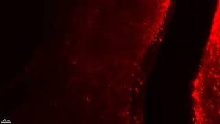 Two-photon Bessel light sheet microscopy mapping dopaminergic neurons in adult rat brain