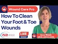 How To Clean Your Foot and Toe Wounds | NP Anne Walsh