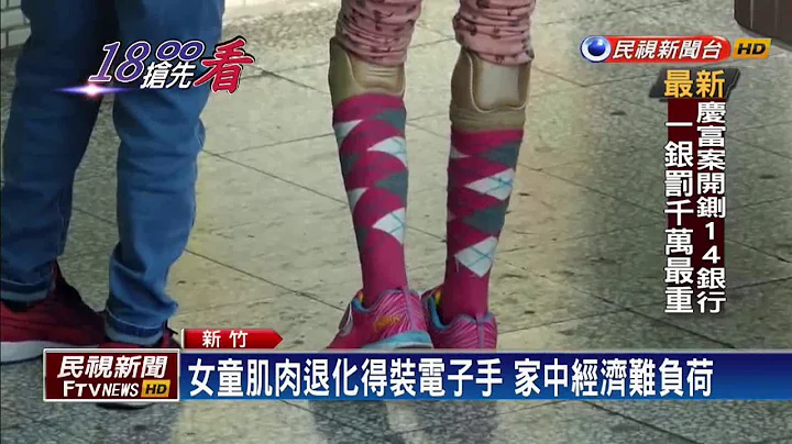 小二童流感重症截肢 校方募款赠电子手－民视新闻 - 天天要闻