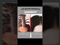 BEST ANTIDANDRUFF SHAMPOO AVAILABLE IN MARKET...#dandruff #shampoo #antidandruffshampoo
