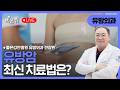 (부산) 유방암의 최신치료 / 좋은강안병원 유방외과 전창완