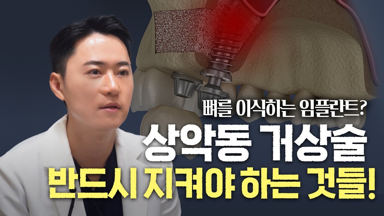 상악동 거상술 후 ‘이것’ 안 지키면 임플란트 실패합니다