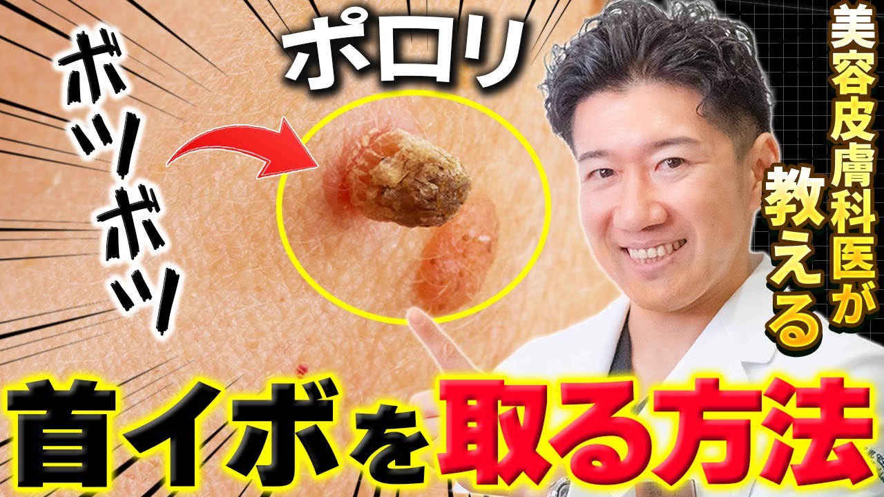 確かイボですか?