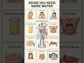 Warning Signs Your Body Needs More Water💧Don’t Ignore These Symptoms #dehydration #healthshorts