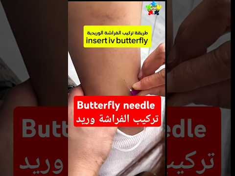 كيف تركب الفراشة    