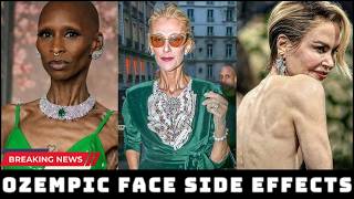 Ozempic Face Celebs Too Far Gone | Weight Loss, Side Effects, Before After