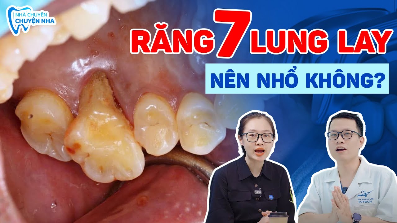 Răng Số 7 Lung Lay Có Nên Nhổ Không? Làm Gì Để Răng Lung Lay Chắc Lại?