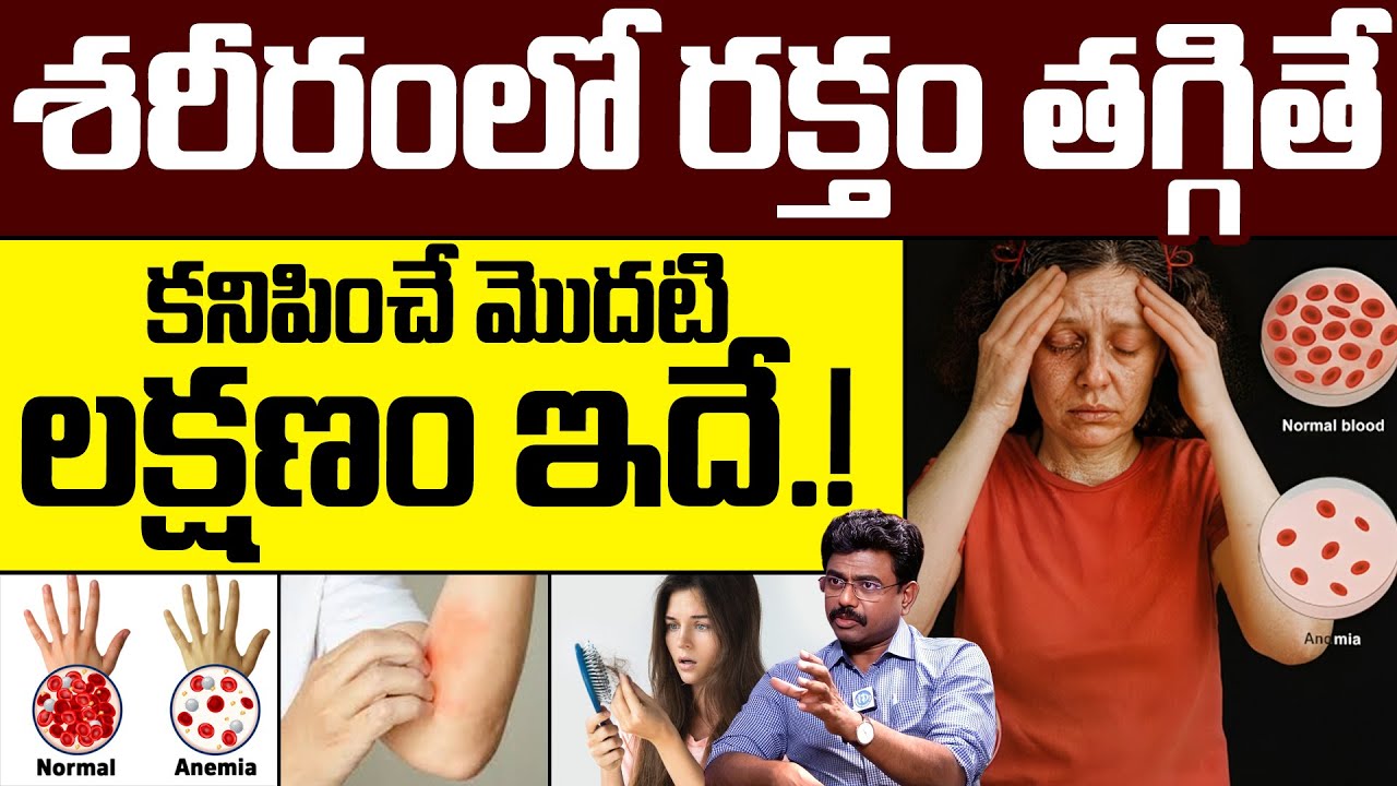 శరీరంలో రక్తం తగ్గితే కనిపించే మొదటి లక్షణం ఇదే.! | What are The Symptoms of Anemia? | Dr Rajesh