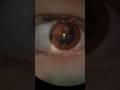High Mag Eye Inspection #asmr #shorts