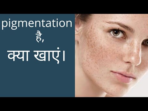 PIGMENTATION क्या खाये ? By Dr. Manoj Das