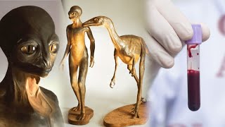 Zbulohet njeriu me gjak dinozauri. 4 raste në të gjithë botën me këtë grup gjaku | ABC News Albania - YouTube