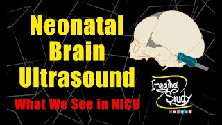 Neonatal Brain Ultrasound || What We See in NICU || Imaging Study Lecture screenshot 4