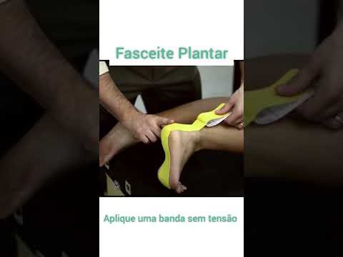Vídeo: 3 maneiras de colocar fita adesiva no pé para fascite plantar
