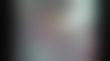 Clipping of right A1 A2 junction aneurysm