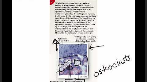 Chapter 6 Module 2 Bone Growth, Modeling, and Remodeling