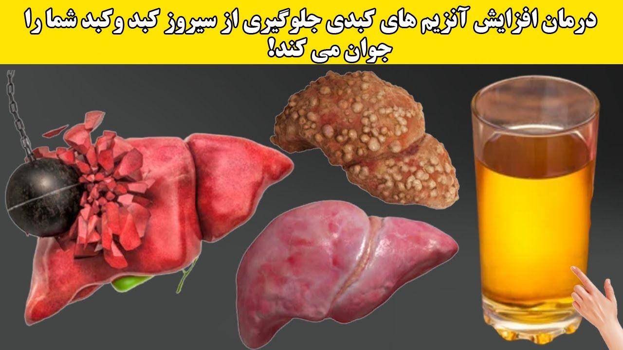 کبد را کامل تمیز می کند درمان افزایش آنزیم های کبدی جلوگیری از سیروز کبد وکبد شما را جوان می کند کبد را کامل تمیز می کند درمان افزایش آنزیم های کبدی جلوگیری از سیروز کبد وکبد شما را جوان می کند