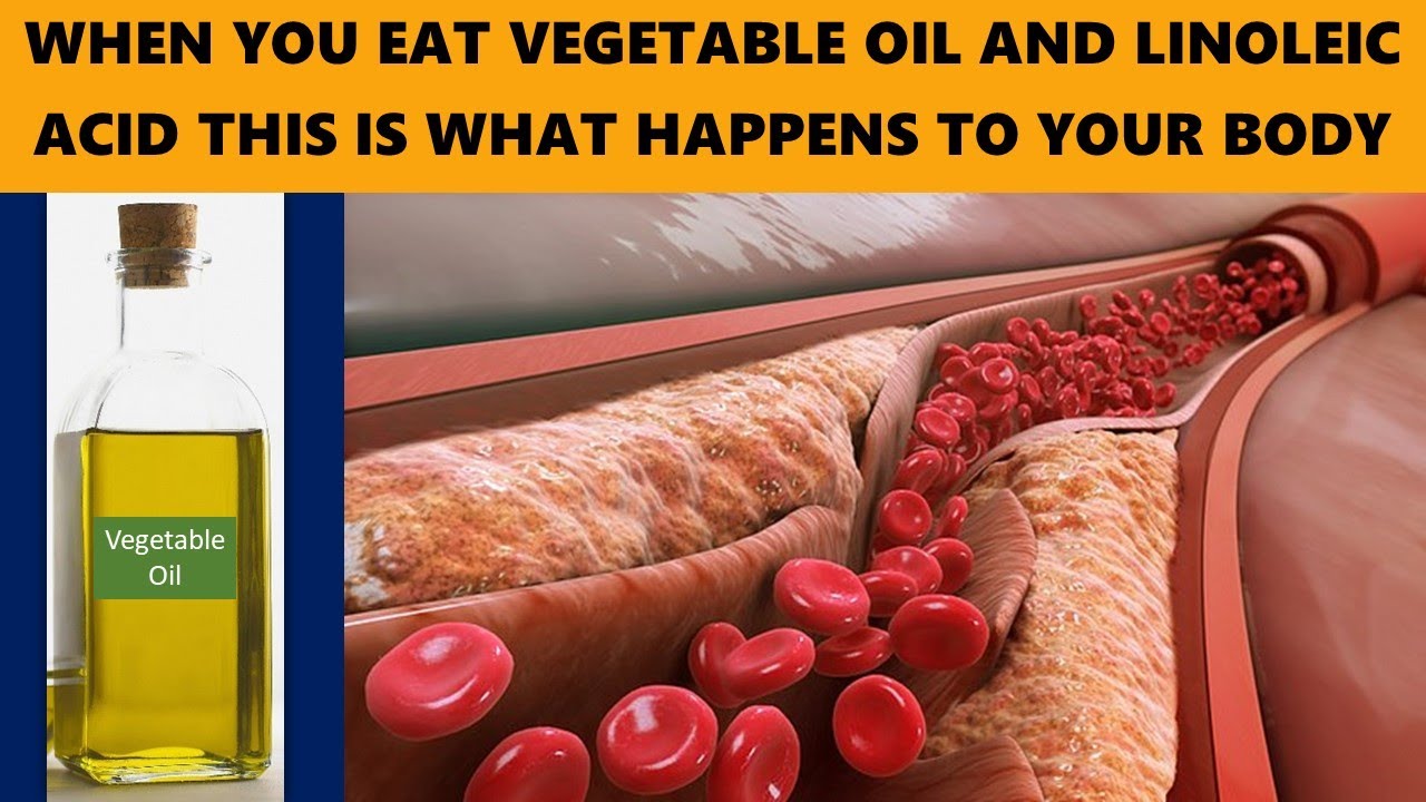 When You Eat Vegetable Oil and Linoleic Acid This Is What Happens To