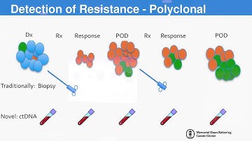 The Role of ctDNA in GIST