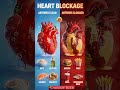 Heart Blockage | Foods To Eat vs Foods To Avoid ❤️🫀