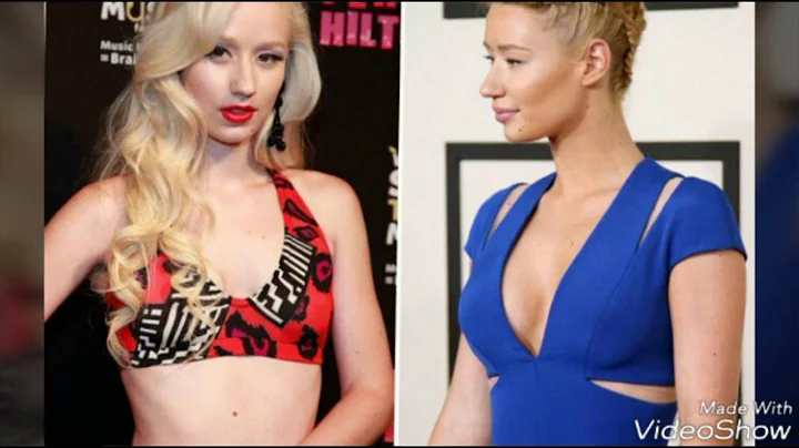 Celebrities before and after surgery