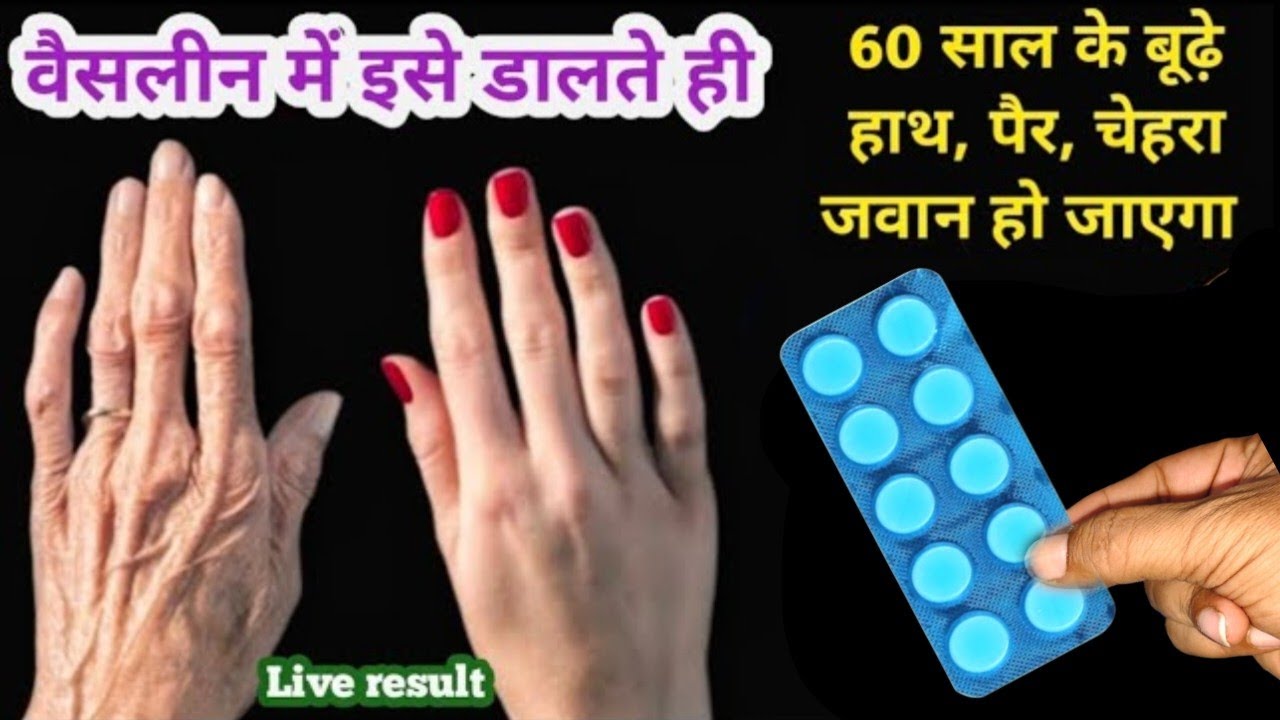 गारंटी है! वैसलीन में इसे डालते ही 60 साल के बूढ़े हाथ चेहरा भी जवान हो जाएगा II No Wrinkle problem