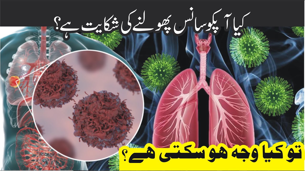 Shortness of breath can be cause by vitamin D Shocking Facts YouTube