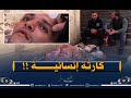 مشاهد تمز ق القلب مريض تحت رحمة الشارع قصة تختصر معاناة خالد 