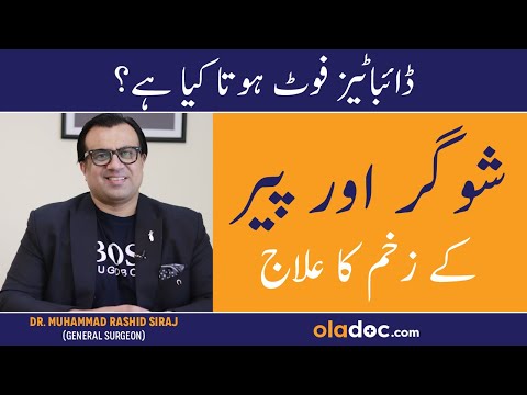Diabetic Foot Management In Urdu - Sugar Ke Zakhan Ka Ilaj - Diabetic Foot Causes And Treatment thumbnail image