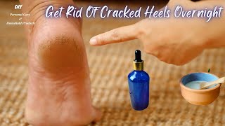 DIY- Get Rid Of Cracked Heels Overnight | Best Home Remedies For Soft & Supple Feet